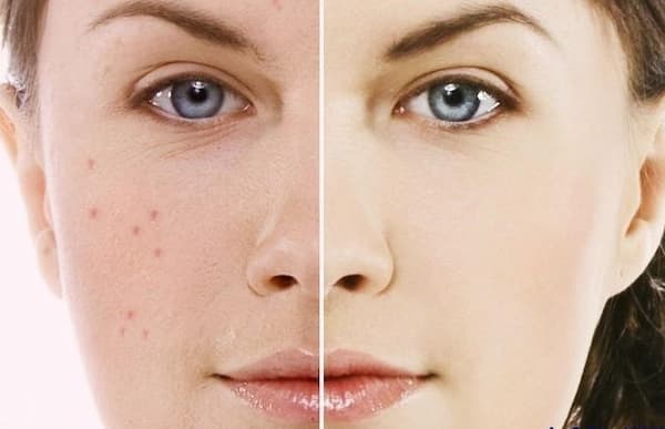 تصویر 2 از فروش گلنار فارسی برای پوست + قیمت خرید به صرفه